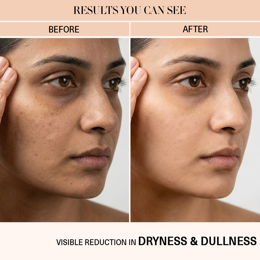 Moongleam- Precious Gel Cream