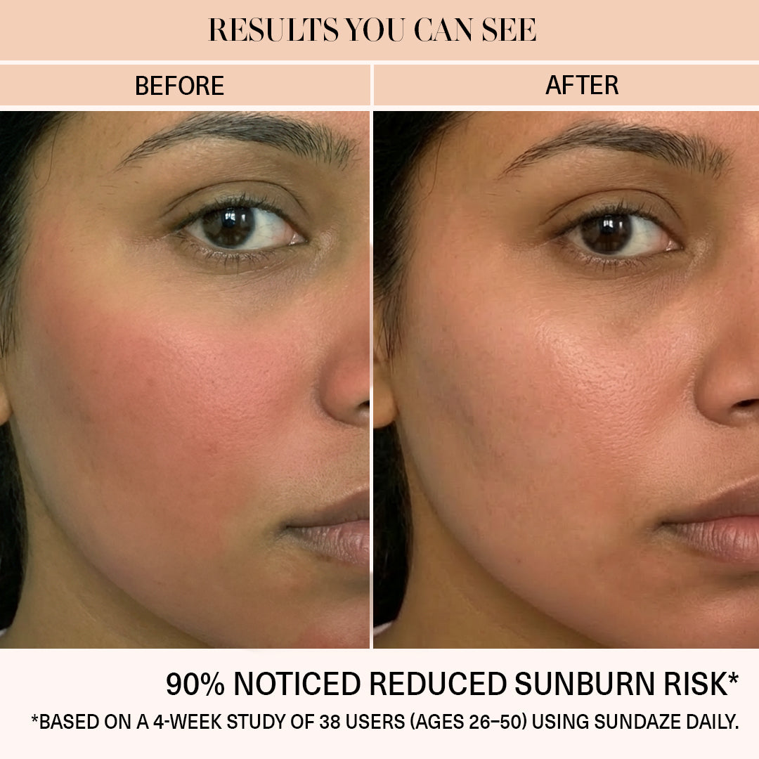 sundaze spf natural non comedogenic sunscreen
uva and uvb sunscreen