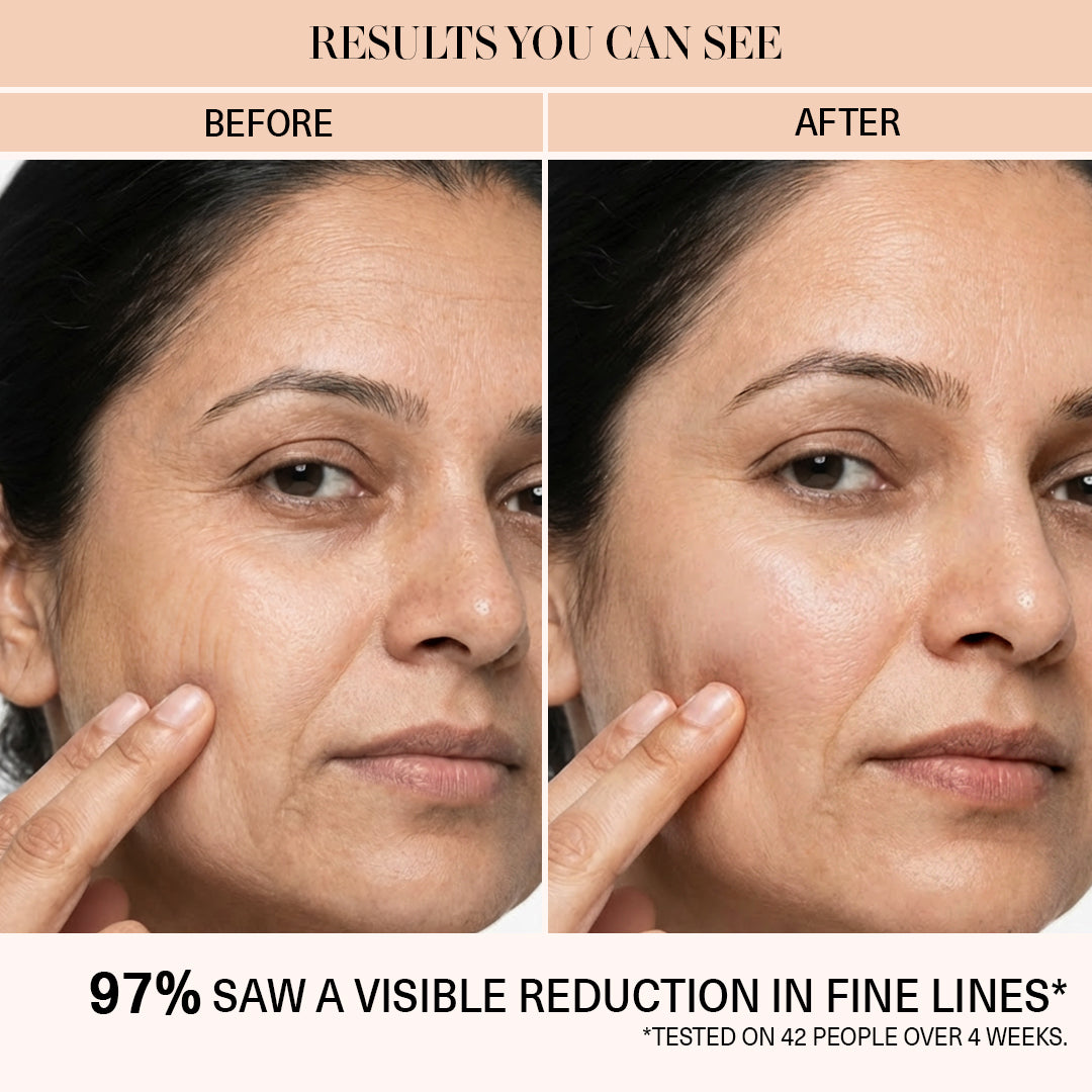 fine lines cream before / after