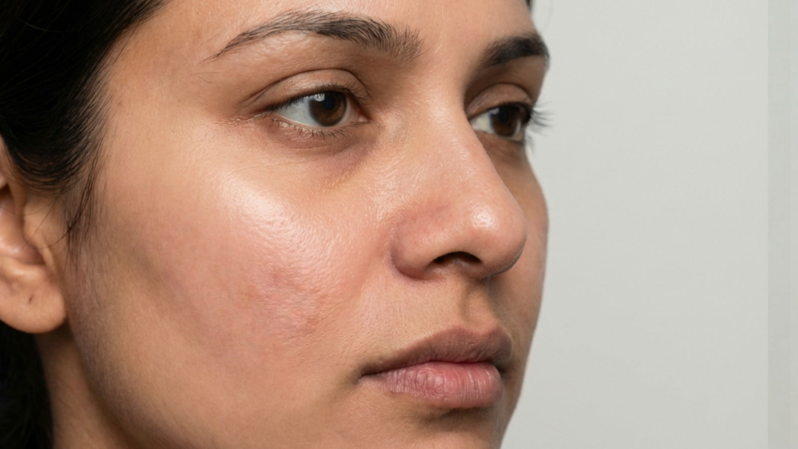 IMPROVED SKIN TEXTURE