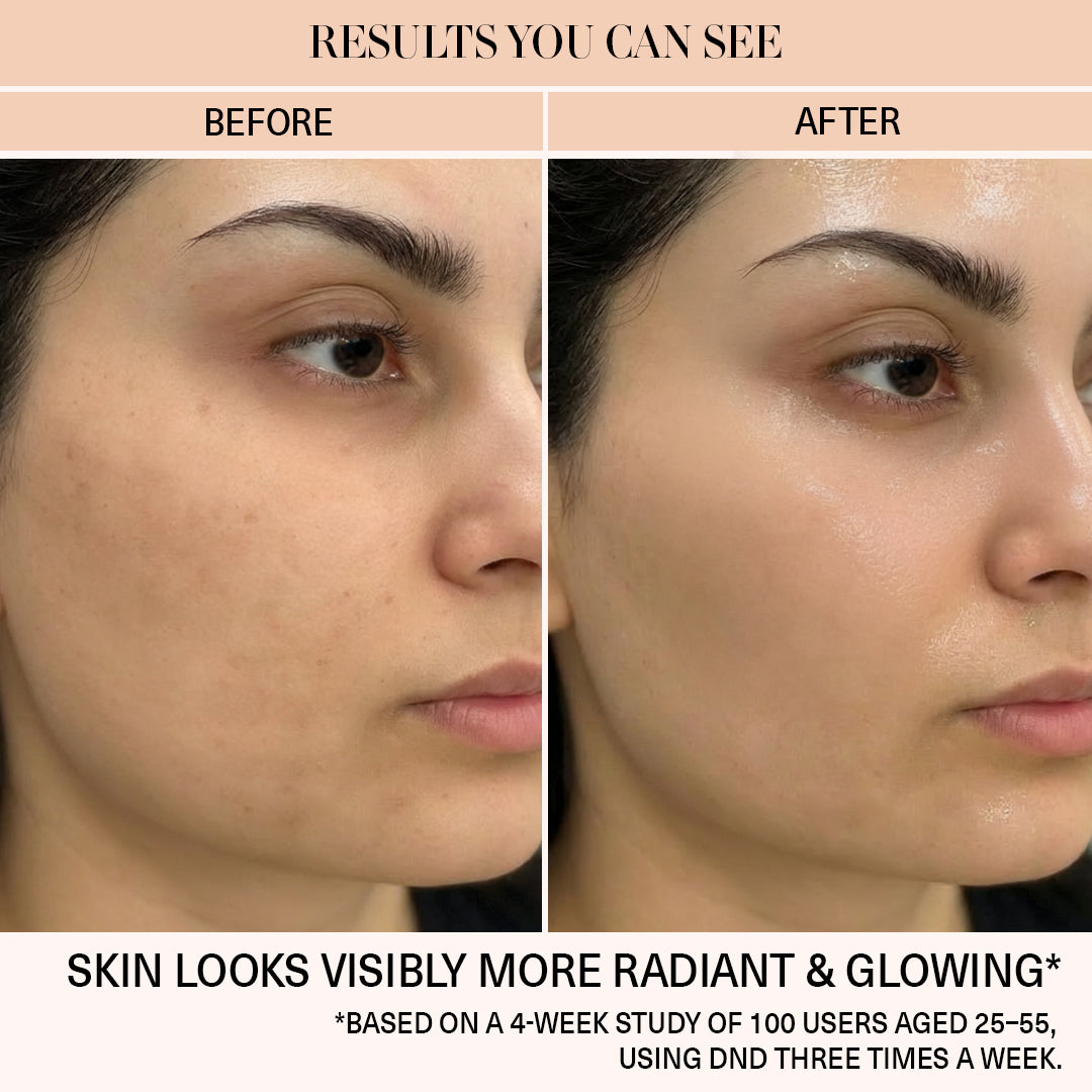 hydrating face mask for dry skin before after