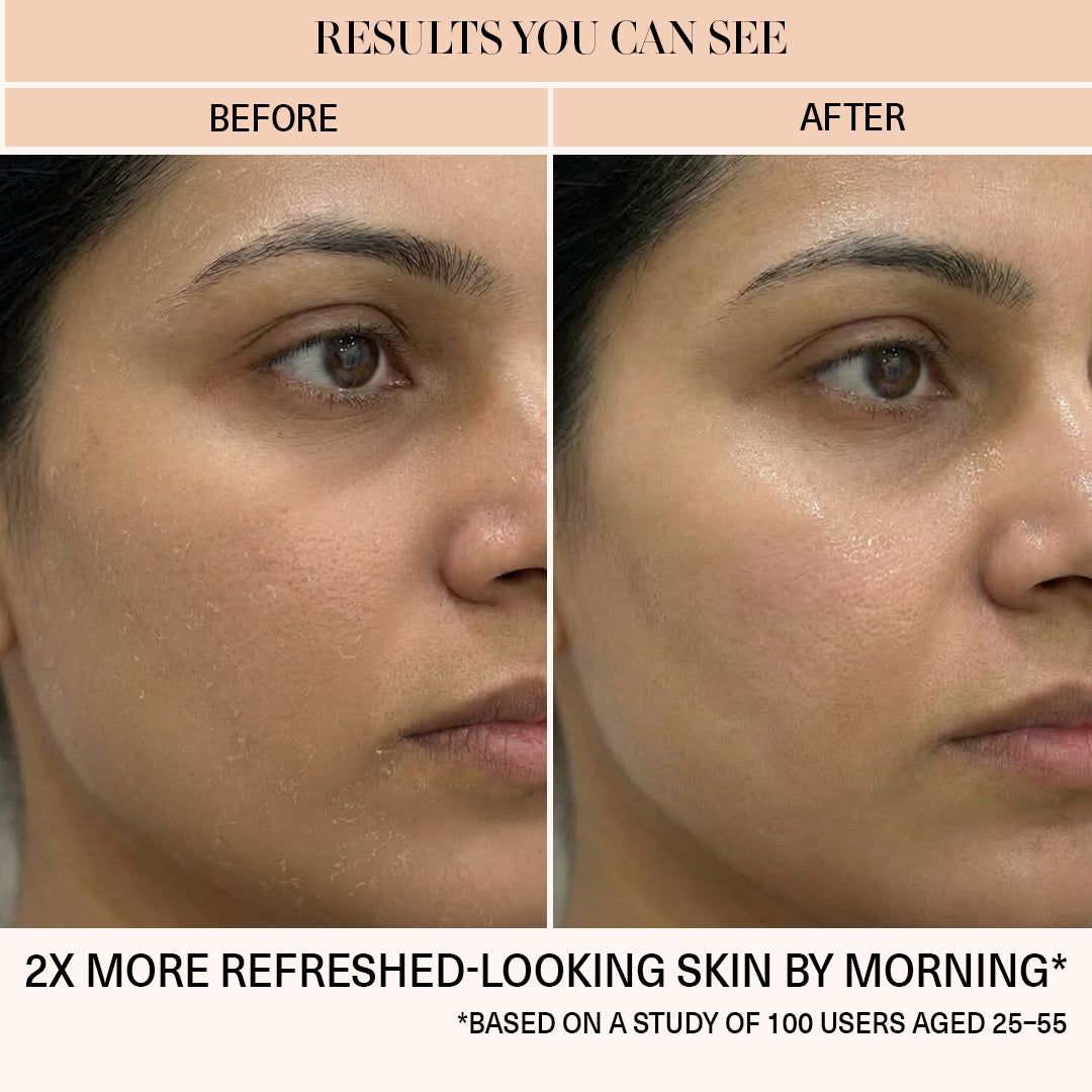 damaged skin barrier and glowing before and after result