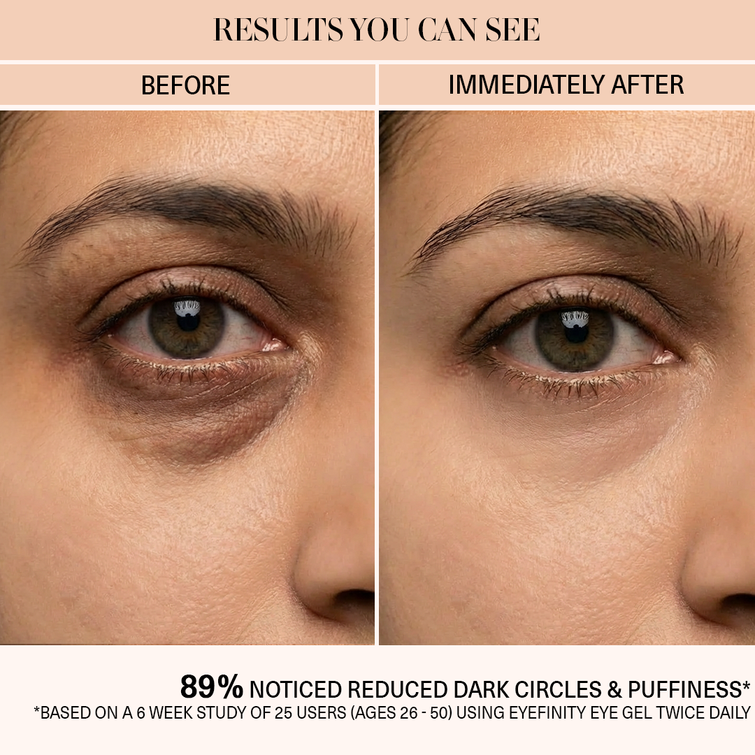 Eyefinity- All-in-one Under Eye Gel