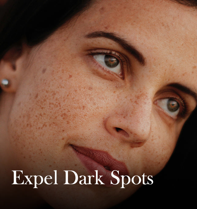 BiE'S Pigmentation Kit: Say no to dark spots