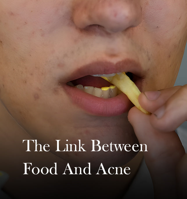 From Plate to Pimple: Foods That Trigger Acne