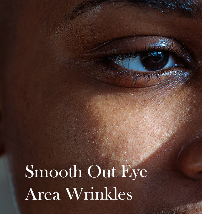 7 Reasons You Have Under-Eye Wrinkles and What to Do About It
