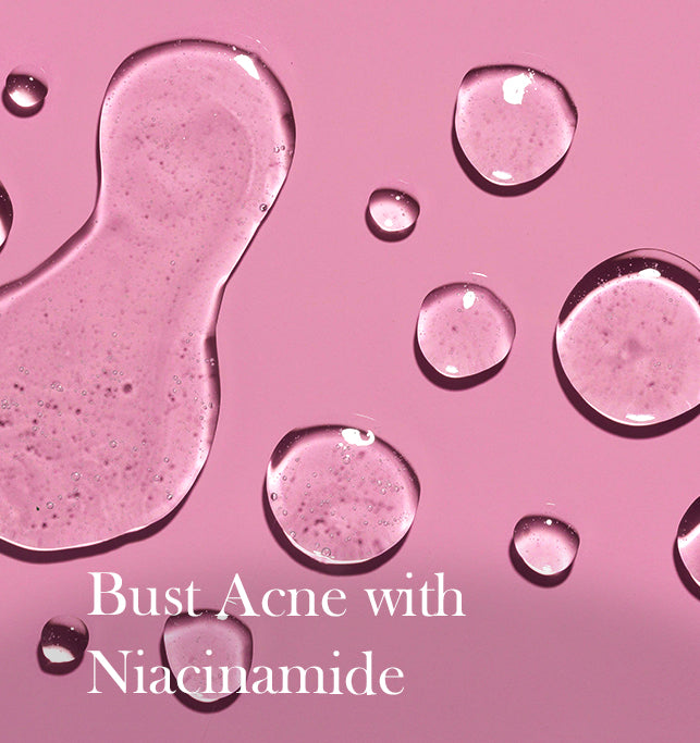 Benefits of Niacinamide for Acne-Prone Skin