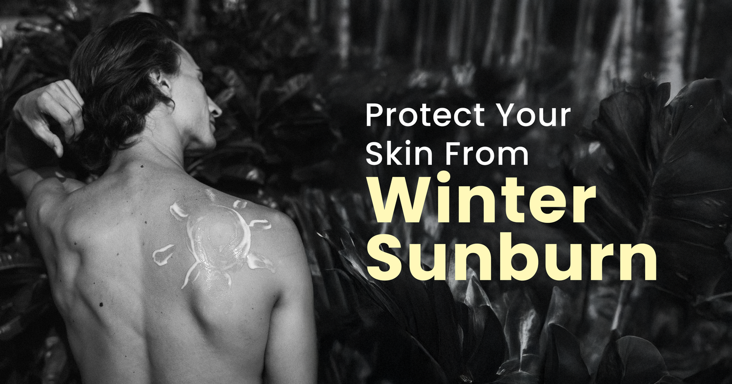 winter skin care