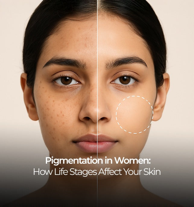 pigmentation in women - women's day special