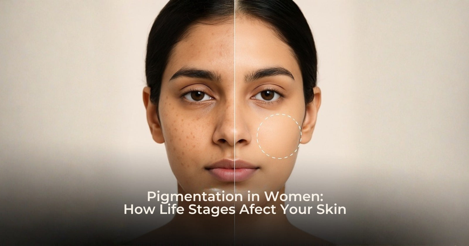 Pigmentation in women