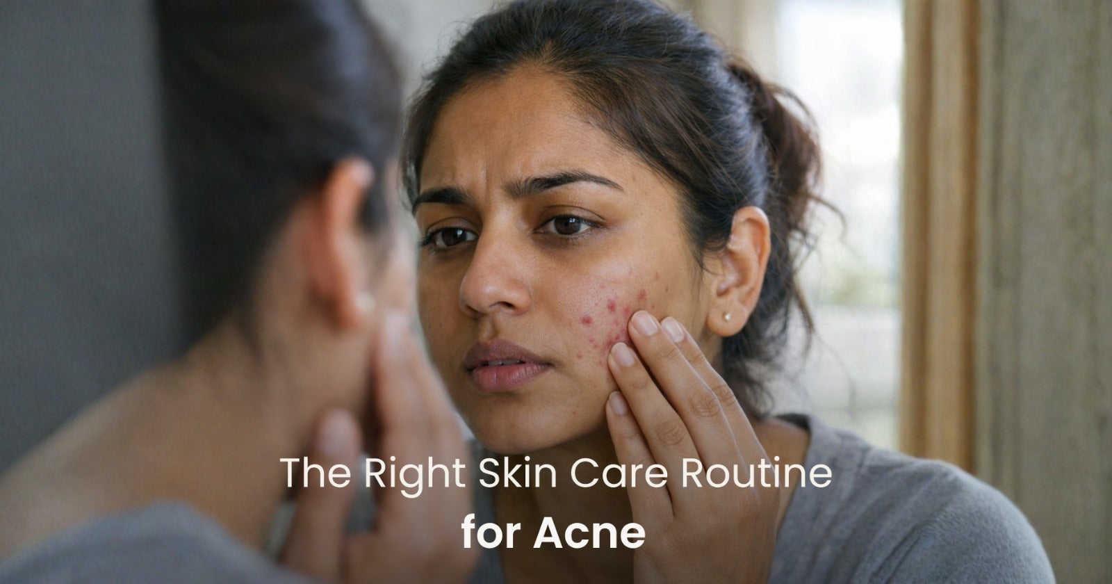 acne skin care