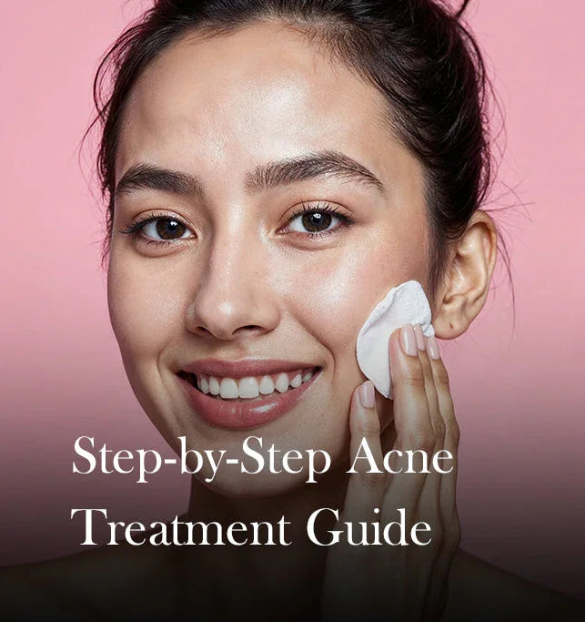 Step-by-Step Acne Treatment for Clear Skin
