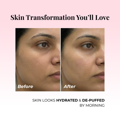 hydrating and depuffing - before and after