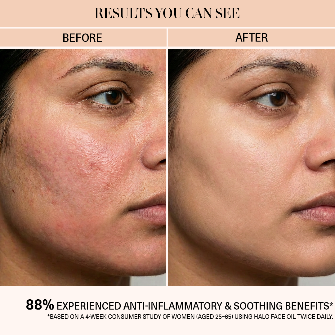 inflammation before and after