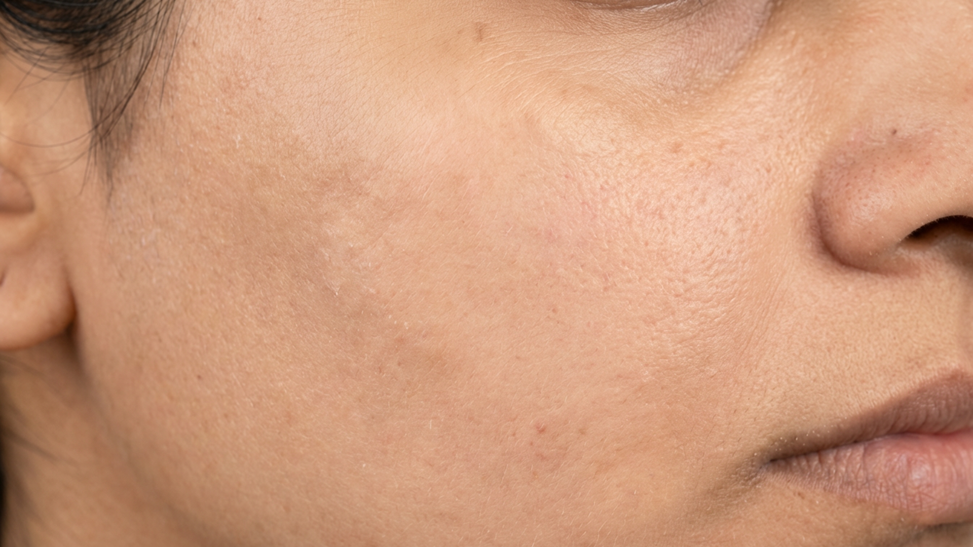 after using face mask for pigmentation