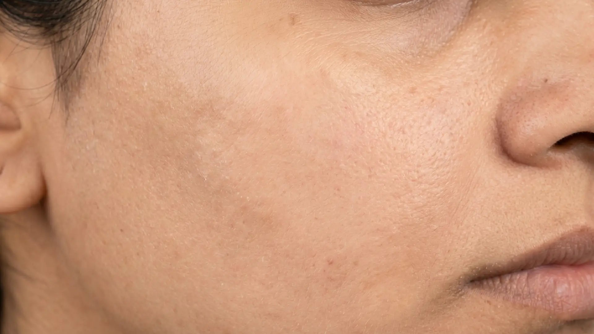 after using face mask for pigmentation