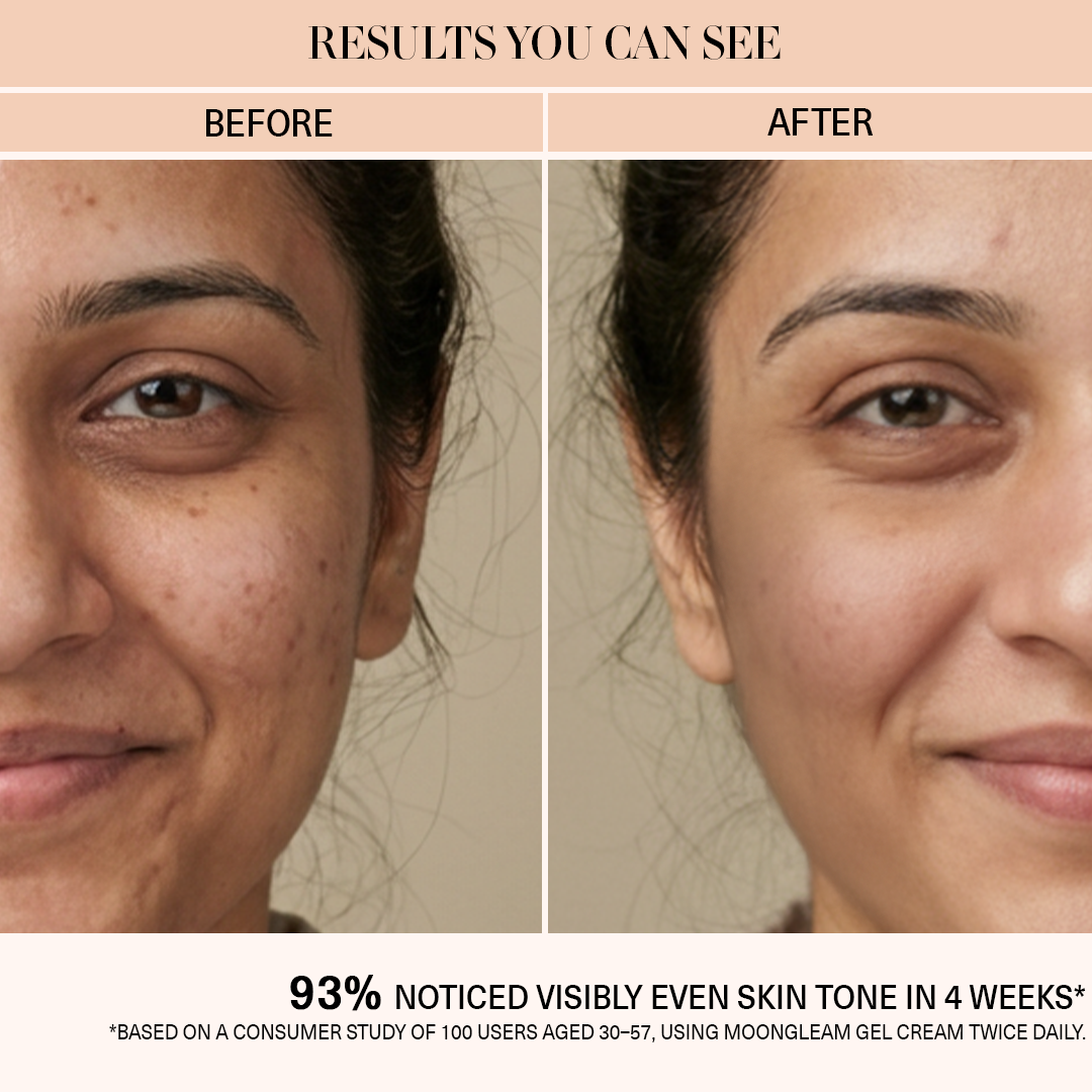 Moongleam- Precious Gel Cream