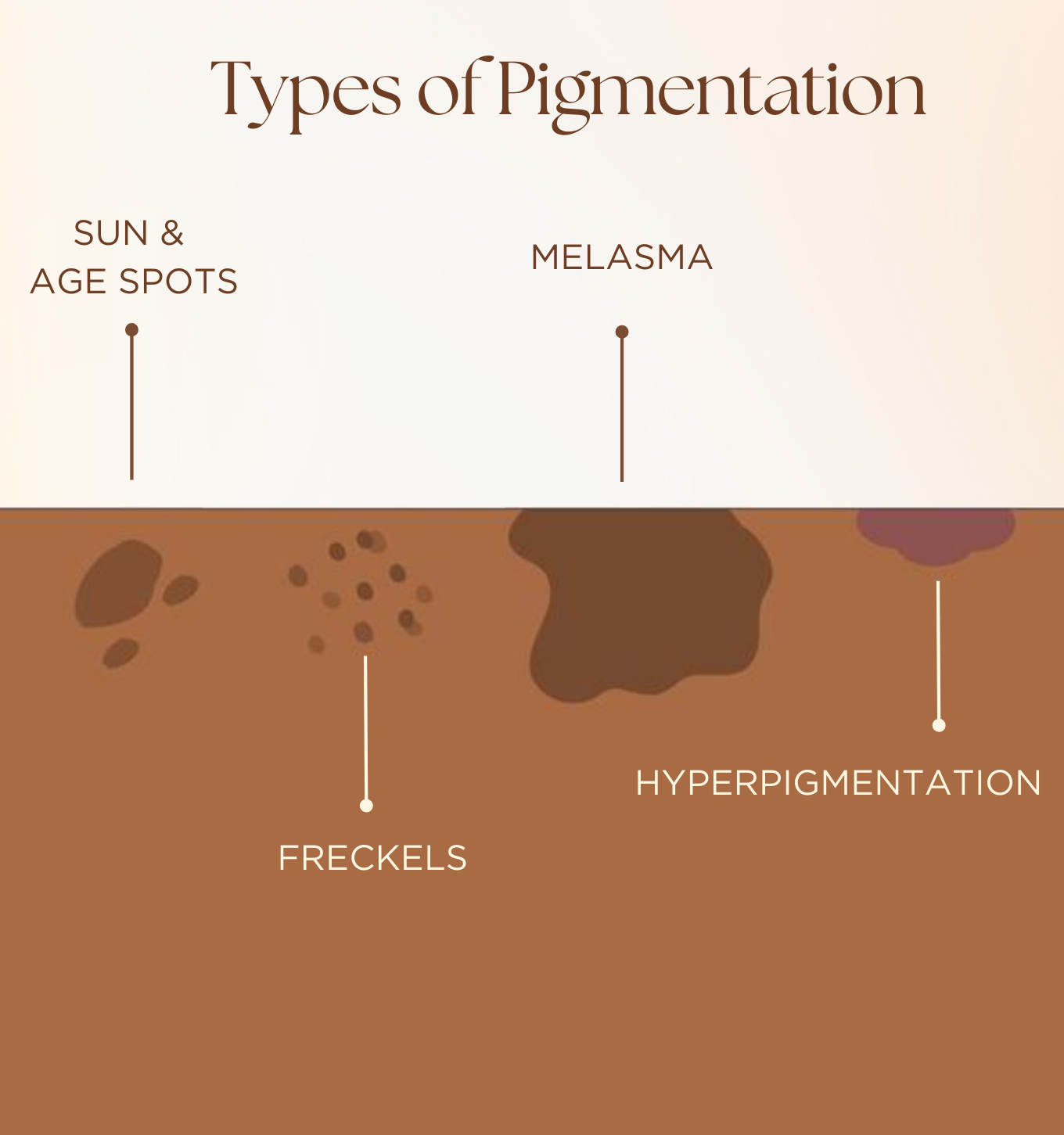 types of pigmentation on face, anti pigmentation facial, best product for pigmentation on face, skin products for even skin tone, reduce hyperpigmentation​