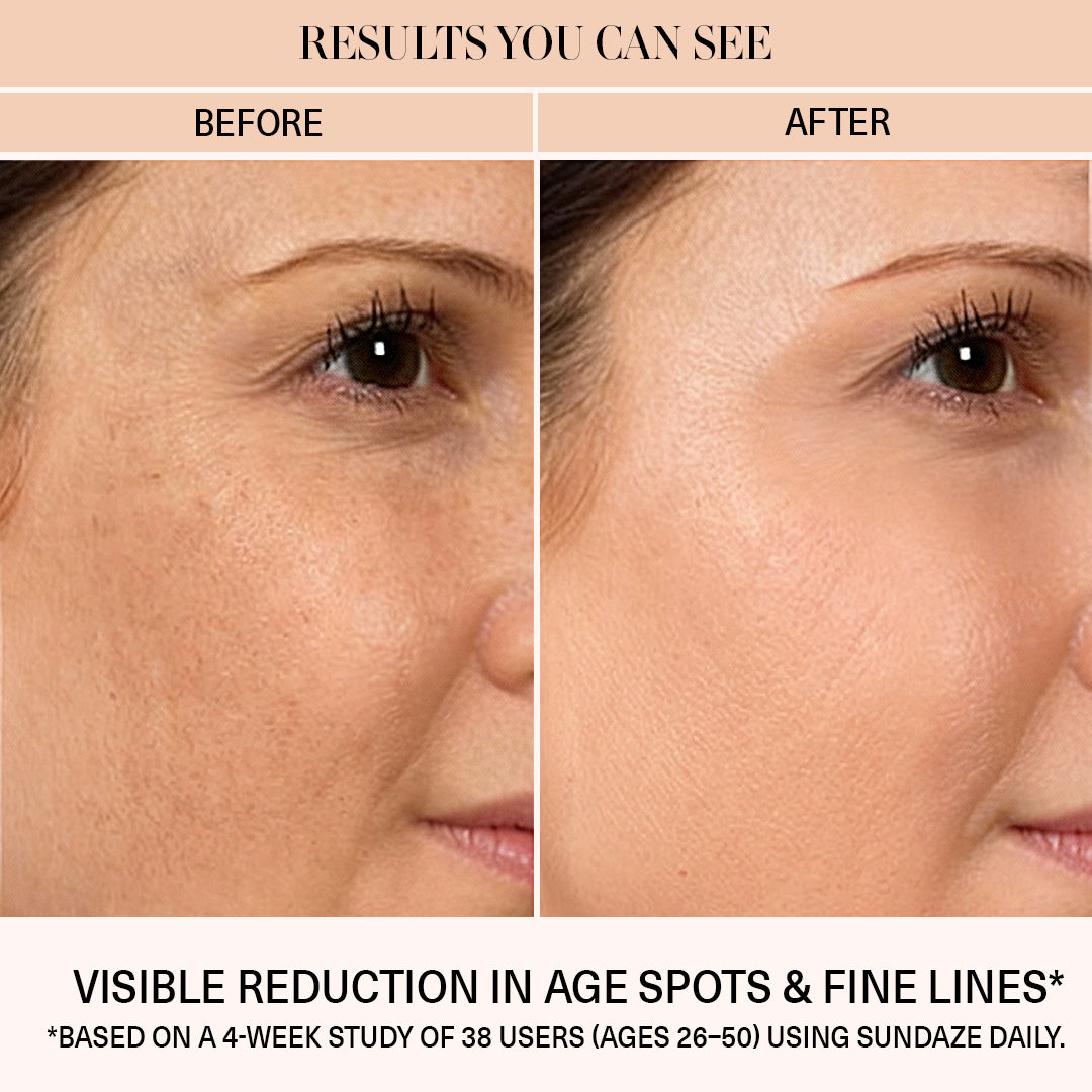 fine lines and age spots before after image