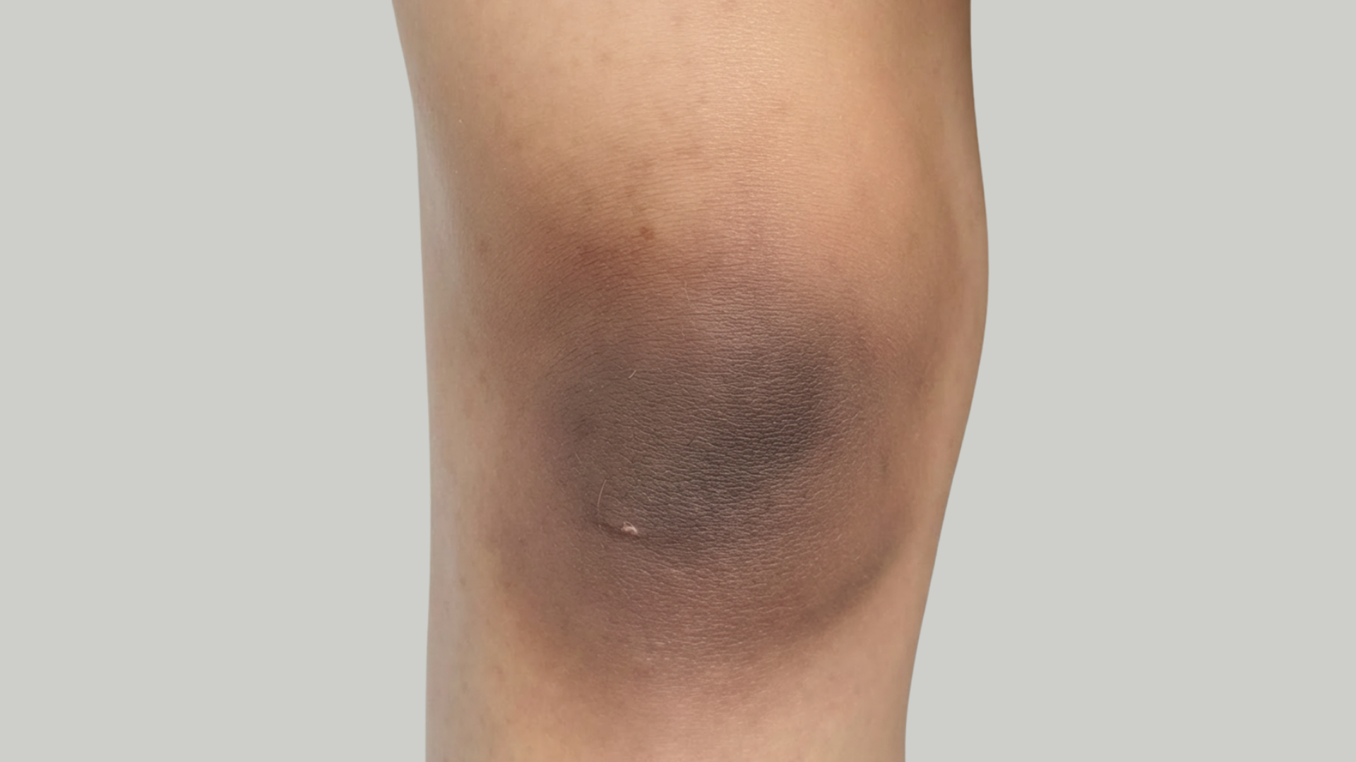 de tan before and after​