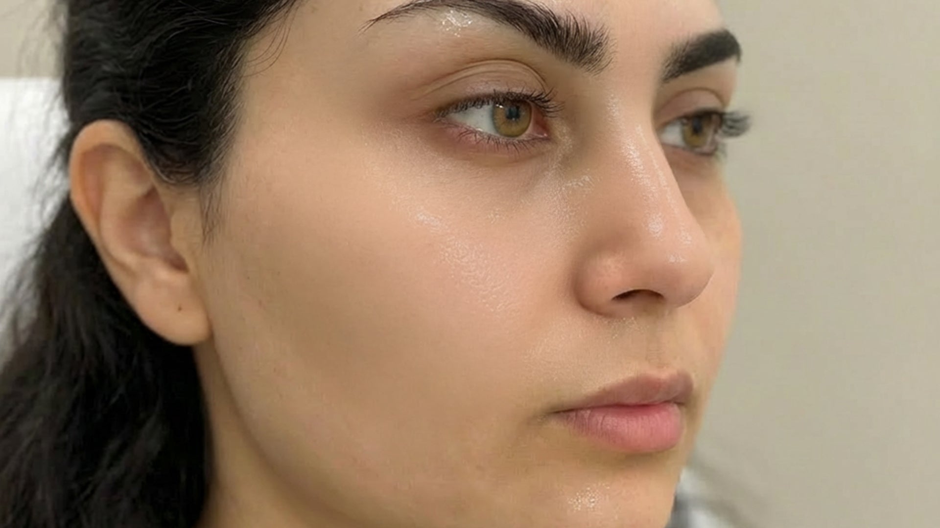 hydrating skin care before and after