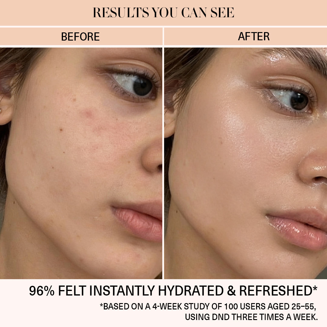 hydrated skin before and after