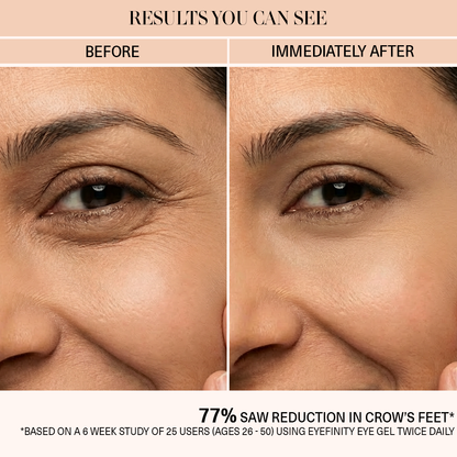 Eyefinity- All-in-one Under Eye Gel