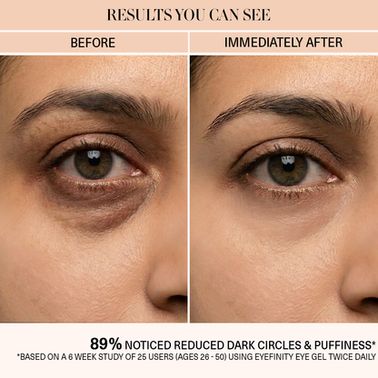 Eyefinity- All-in-one Under Eye Gel