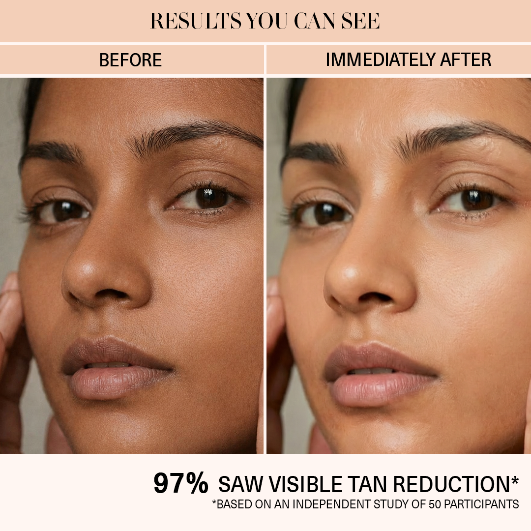 Anti - Pigmentation Kit