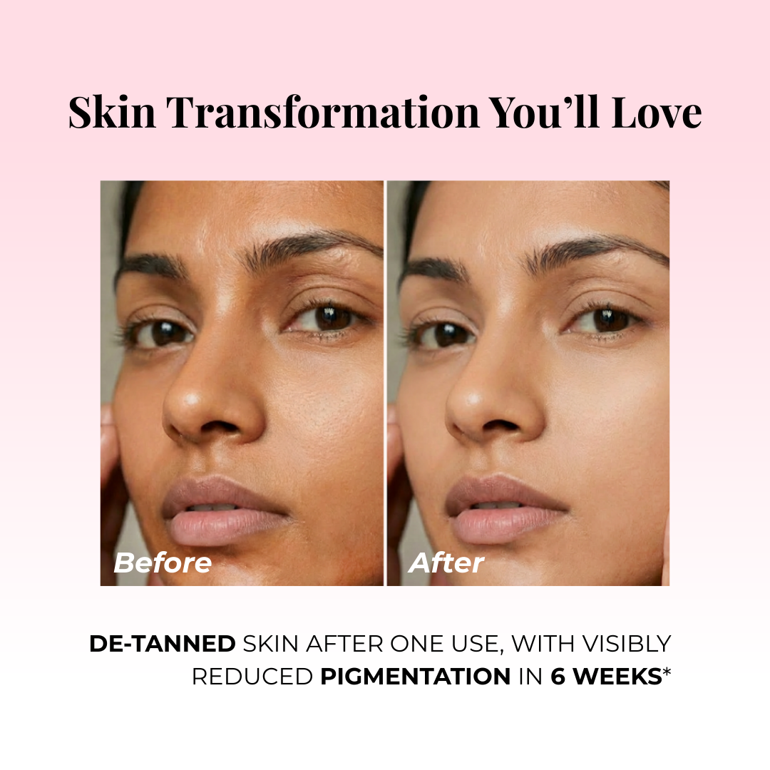 face serum for pigmentation - before and after result