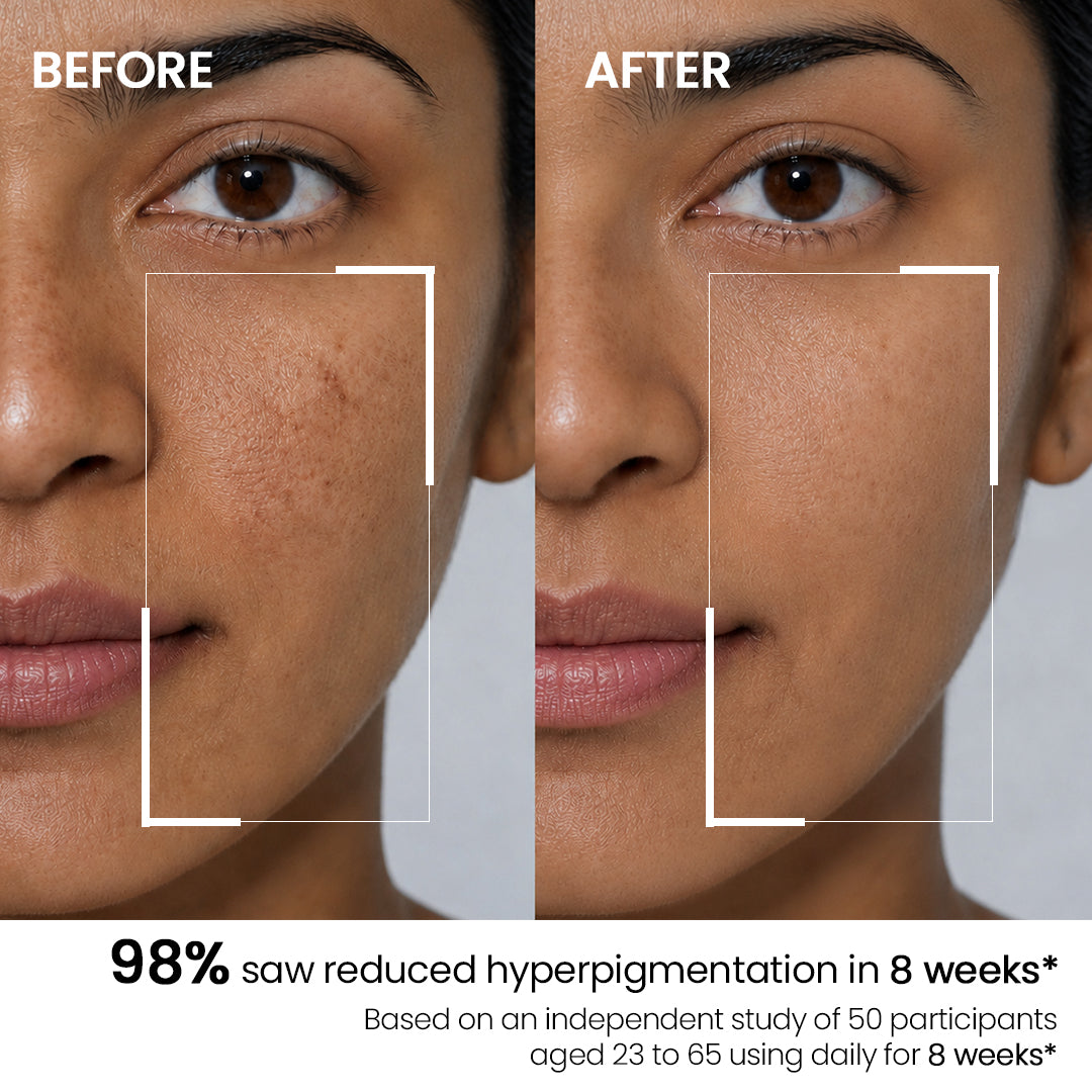 skin brightening serum