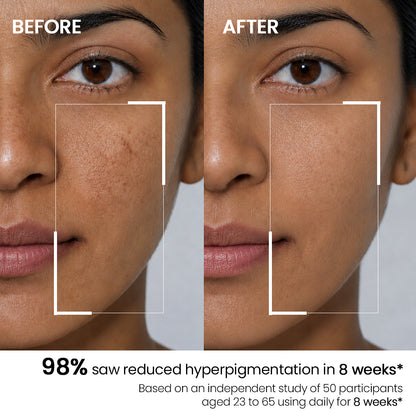 skin brightening serum