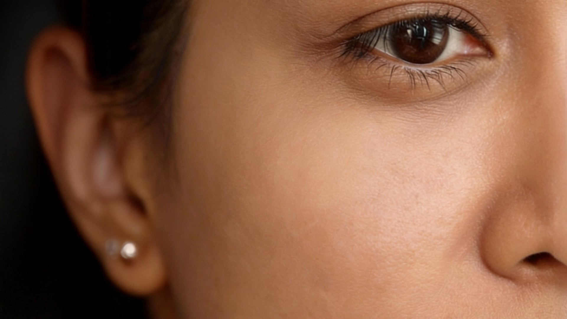 reduce hyperpigmentation