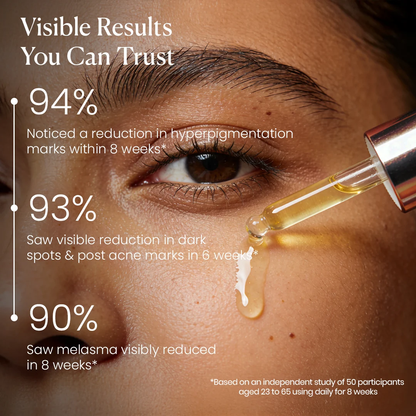 Zero Dark Spot Corrector &amp; Anti-Pigmentation Serum 10ml