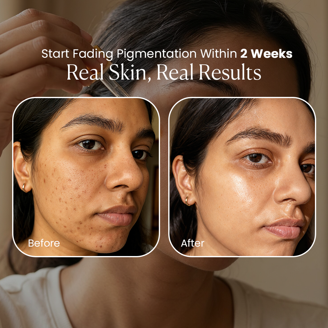 skin brightening serum